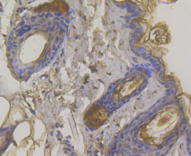 Desmoglein 3 Antibody in Immunohistochemistry (Paraffin) (IHC (P))