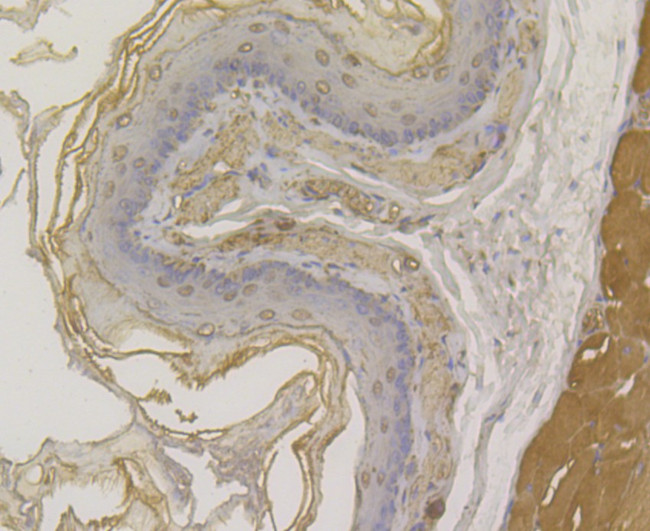 Desmoglein 3 Antibody in Immunohistochemistry (Paraffin) (IHC (P))