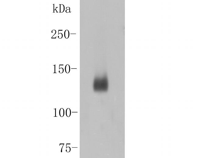 Desmoglein 3 Antibody in Western Blot (WB)