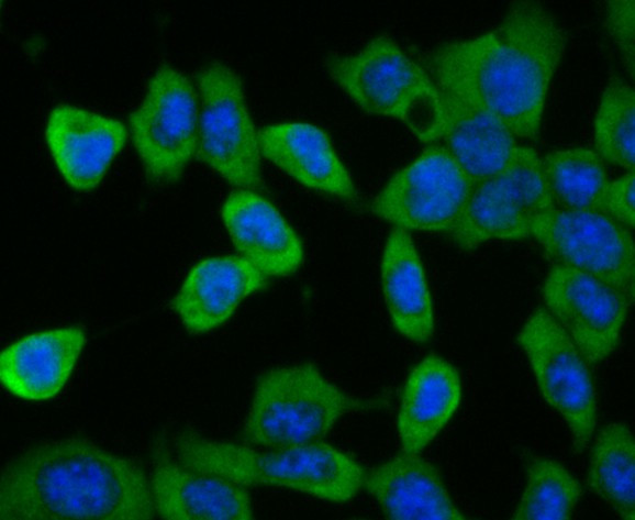 CD35 Antibody in Immunocytochemistry (ICC/IF)