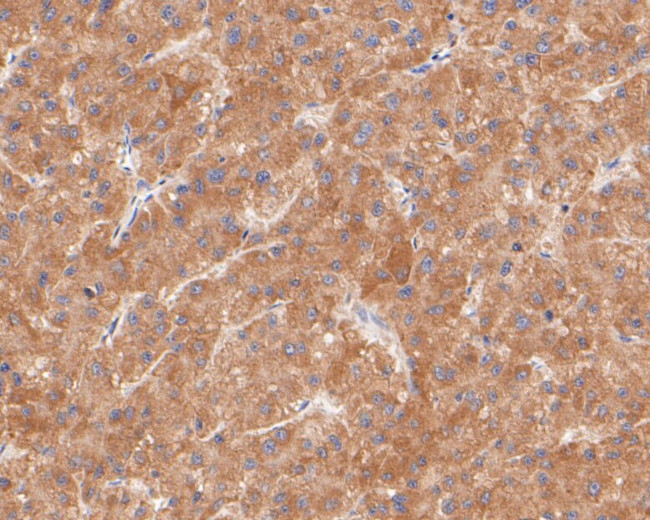 KCNK2 Antibody in Immunohistochemistry (Paraffin) (IHC (P))