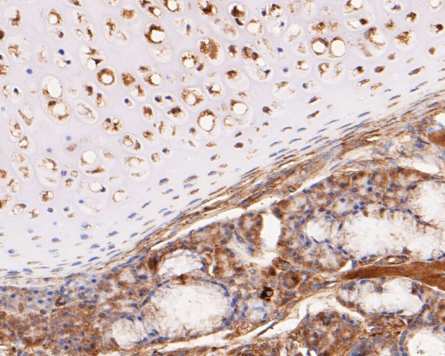 KCNK2 Antibody in Immunohistochemistry (Paraffin) (IHC (P))