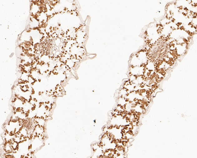 Beta-adaptin-like protein A Antibody in Immunohistochemistry (Paraffin) (IHC (P))