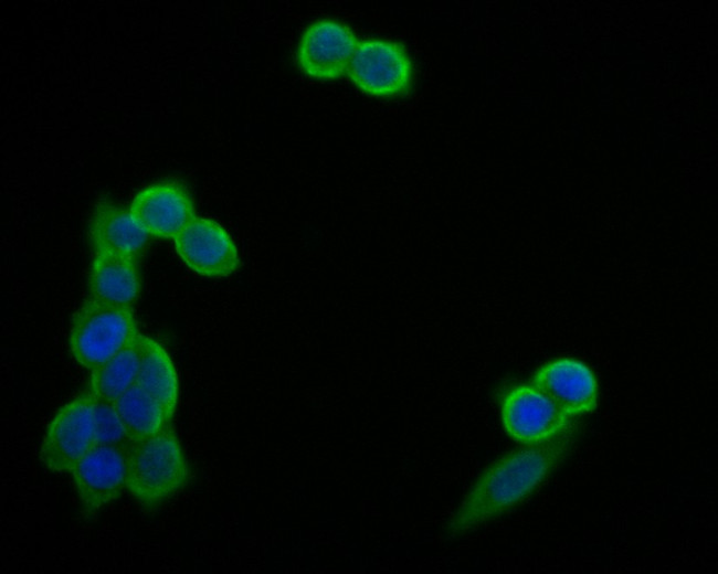 GM648 Antibody in Immunocytochemistry (ICC/IF)