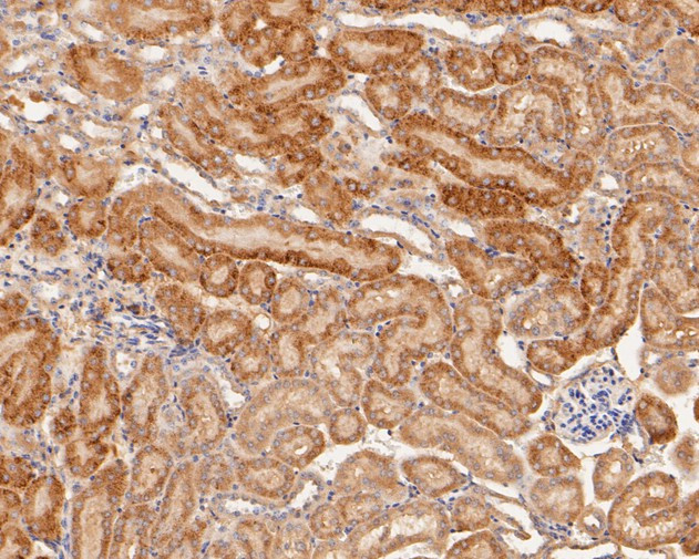 GM648 Antibody in Immunohistochemistry (Paraffin) (IHC (P))