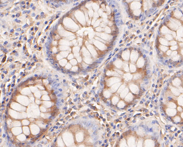 KCNN2 Antibody in Immunohistochemistry (Paraffin) (IHC (P))