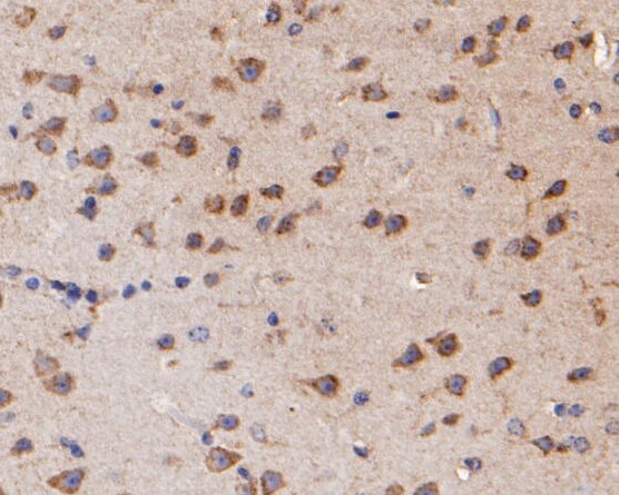 KCNN2 Antibody in Immunohistochemistry (Paraffin) (IHC (P))