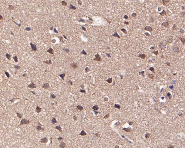 KCNN2 Antibody in Immunohistochemistry (Paraffin) (IHC (P))