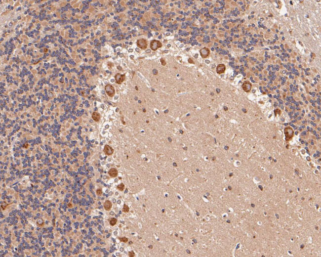 KCNN2 Antibody in Immunohistochemistry (Paraffin) (IHC (P))