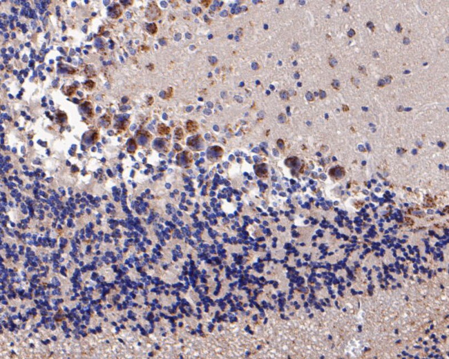 KCNN2 Antibody in Immunohistochemistry (Paraffin) (IHC (P))