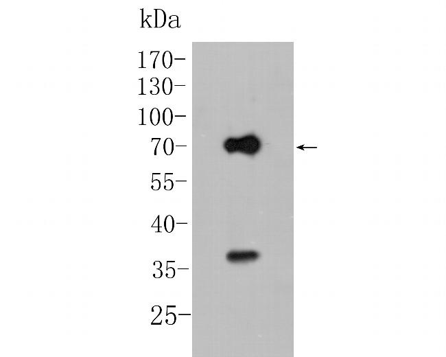 KCNN2 Antibody in Western Blot (WB)