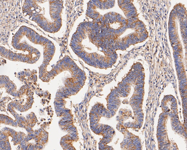 KCNK9 Antibody in Immunohistochemistry (Paraffin) (IHC (P))