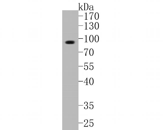 KCNK9 Antibody in Western Blot (WB)