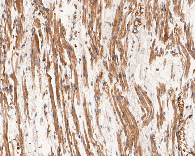 CHRNA1 Antibody in Immunohistochemistry (Paraffin) (IHC (P))