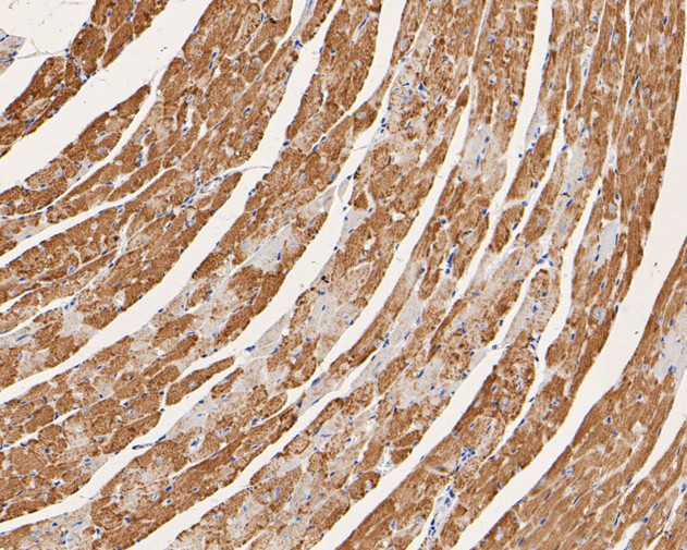 CHRNA1 Antibody in Immunohistochemistry (Paraffin) (IHC (P))