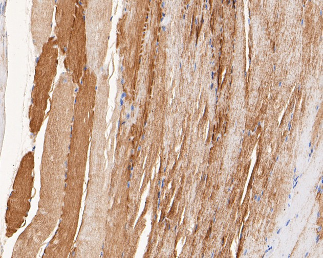 CHRNA1 Antibody in Immunohistochemistry (Paraffin) (IHC (P))