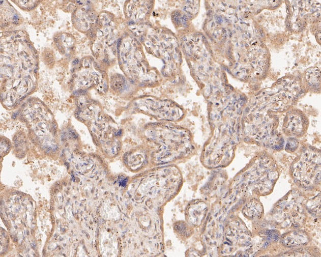 SLC12A9 Antibody in Immunohistochemistry (Paraffin) (IHC (P))