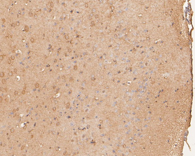 SLC12A9 Antibody in Immunohistochemistry (Paraffin) (IHC (P))