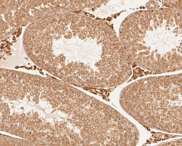 SLC12A9 Antibody in Immunohistochemistry (Paraffin) (IHC (P))