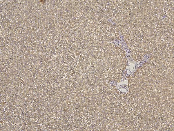 CYP2C19 Antibody in Immunohistochemistry (Paraffin) (IHC (P))