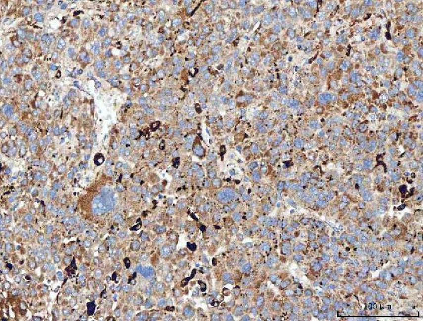 MRC1 Antibody in Immunohistochemistry (Paraffin) (IHC (P))