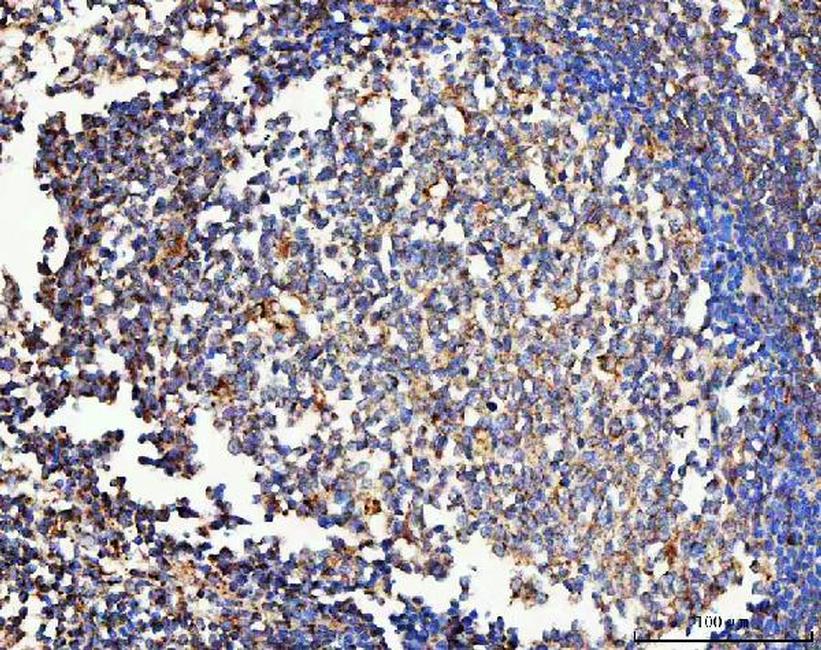 MRC1 Antibody in Immunohistochemistry (Paraffin) (IHC (P))