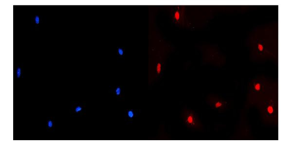 NUP214 Antibody in Immunocytochemistry (ICC/IF)