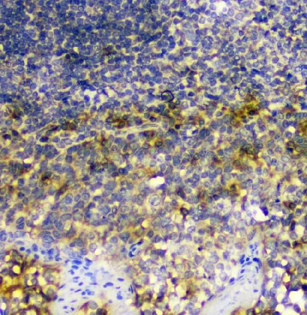 SIRT4 Antibody in Immunohistochemistry (Paraffin) (IHC (P))