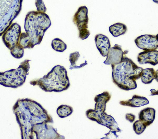 SIRT4 Antibody in Immunohistochemistry (Paraffin) (IHC (P))