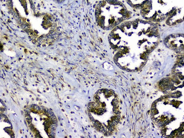 SIRT4 Antibody in Immunohistochemistry (Paraffin) (IHC (P))