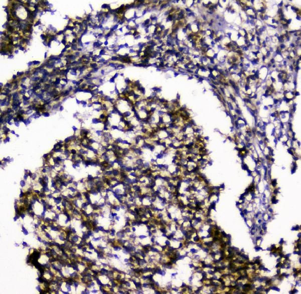 SIRT4 Antibody in Immunohistochemistry (Paraffin) (IHC (P))