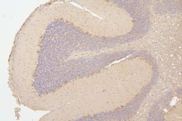 SEMA3B Antibody in Immunohistochemistry (Paraffin) (IHC (P))