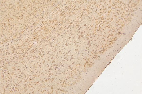 SEMA3B Antibody in Immunohistochemistry (Paraffin) (IHC (P))