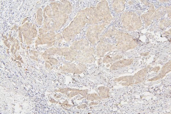 SEMA3B Antibody in Immunohistochemistry (Paraffin) (IHC (P))