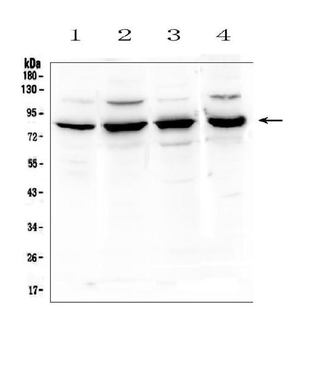 SEMA3B Antibody in Western Blot (WB)