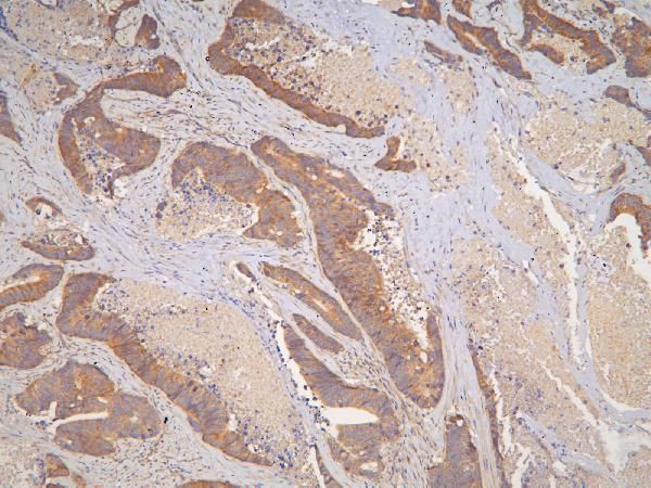 IL-31 Antibody in Immunohistochemistry (Paraffin) (IHC (P))