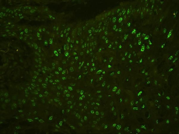 PHF21A Antibody in Immunohistochemistry (Paraffin) (IHC (P))