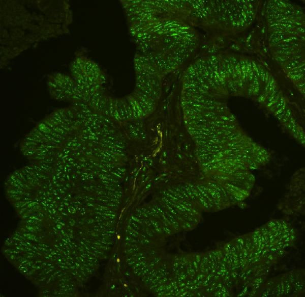 PHF21A Antibody in Immunohistochemistry (Paraffin) (IHC (P))