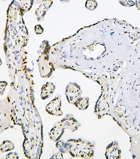 PHF21A Antibody in Immunohistochemistry (Paraffin) (IHC (P))