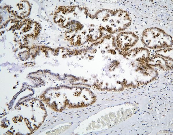 PHF21A Antibody in Immunohistochemistry (Paraffin) (IHC (P))