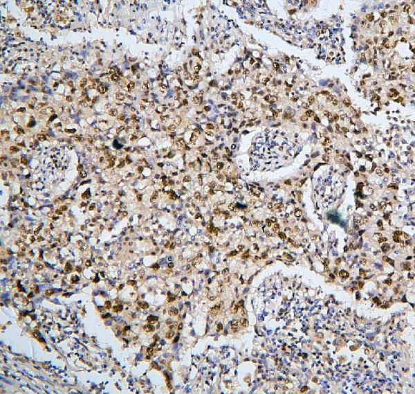 PHF21A Antibody in Immunohistochemistry (Paraffin) (IHC (P))