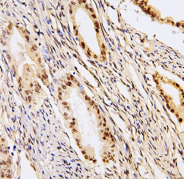 PHF21A Antibody in Immunohistochemistry (Paraffin) (IHC (P))