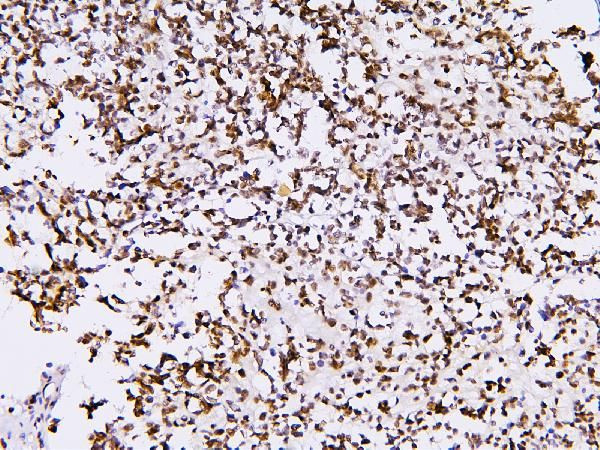 PHF21A Antibody in Immunohistochemistry (Paraffin) (IHC (P))