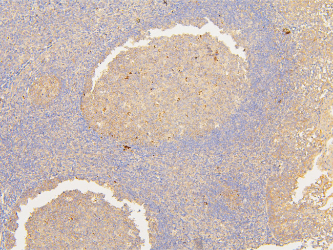 ATP5G1/2/3 Antibody in Immunohistochemistry (Paraffin) (IHC (P))