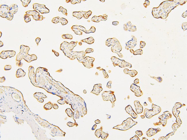 ATP5G1/2/3 Antibody in Immunohistochemistry (Paraffin) (IHC (P))