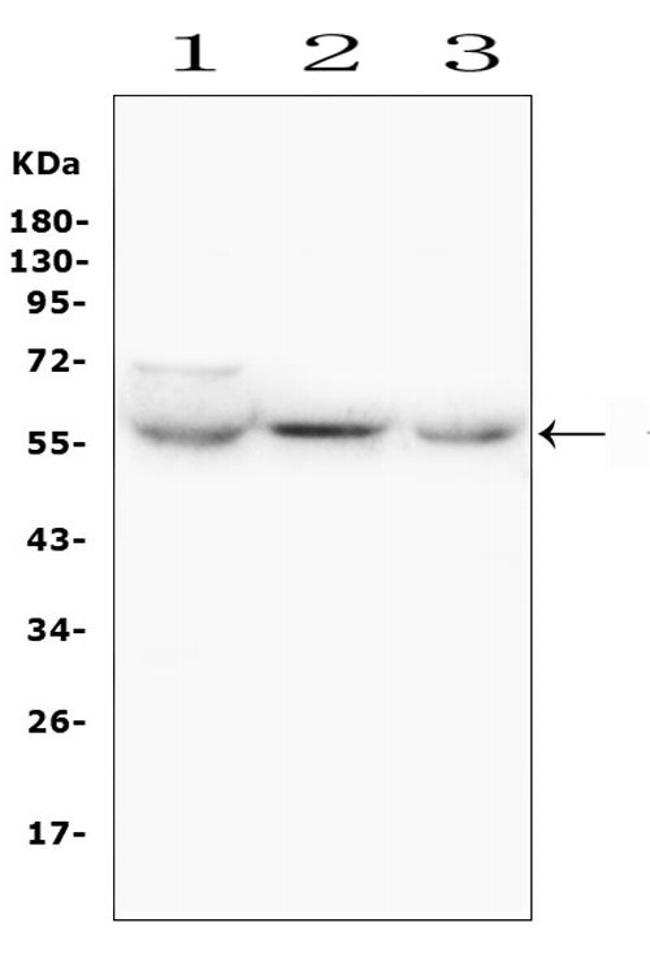 SLC2A6 Antibody in Western Blot (WB)