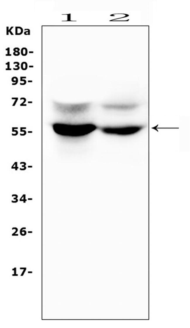 SLC2A6 Antibody in Western Blot (WB)