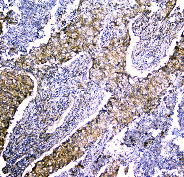 LRTOMT Antibody in Immunohistochemistry (Paraffin) (IHC (P))