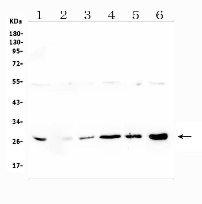 LRTOMT Antibody in Western Blot (WB)