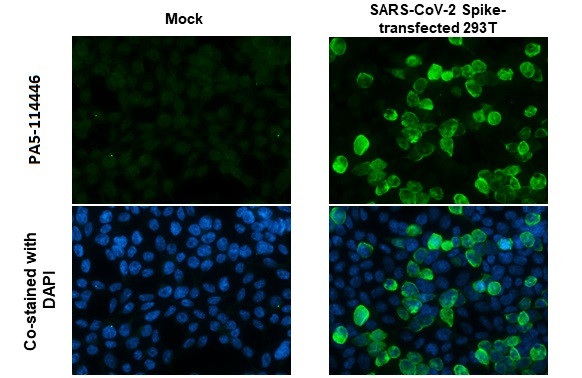 SARS-CoV-2 Spike Protein S1 Antibody in Immunocytochemistry (ICC/IF)